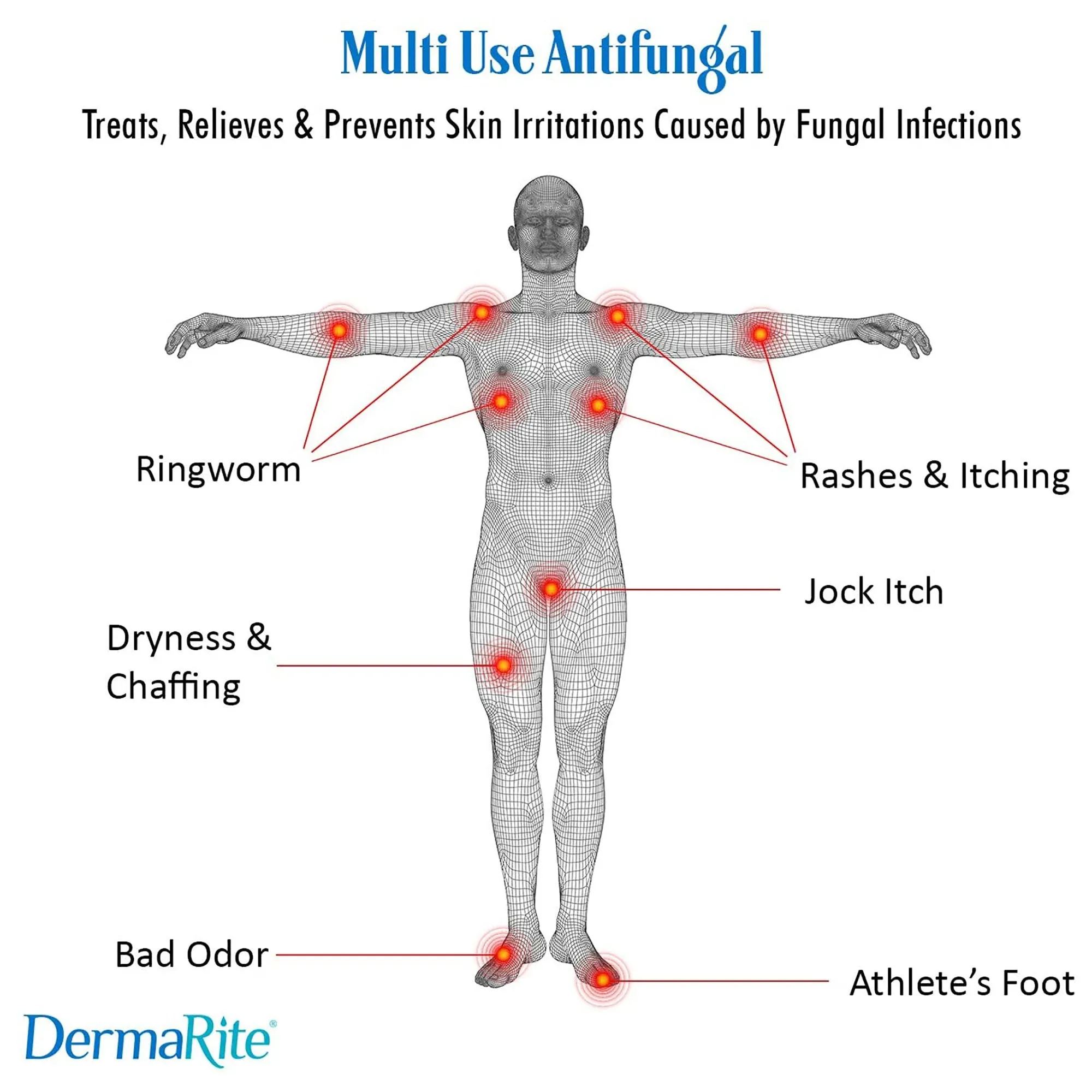 DermaFungal Miconazole Nitrate Antifungal Cream